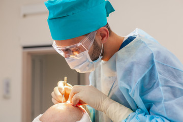 List of India Hair transplantation clinics