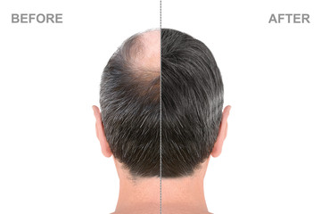 List of England Hair transplantation clinics